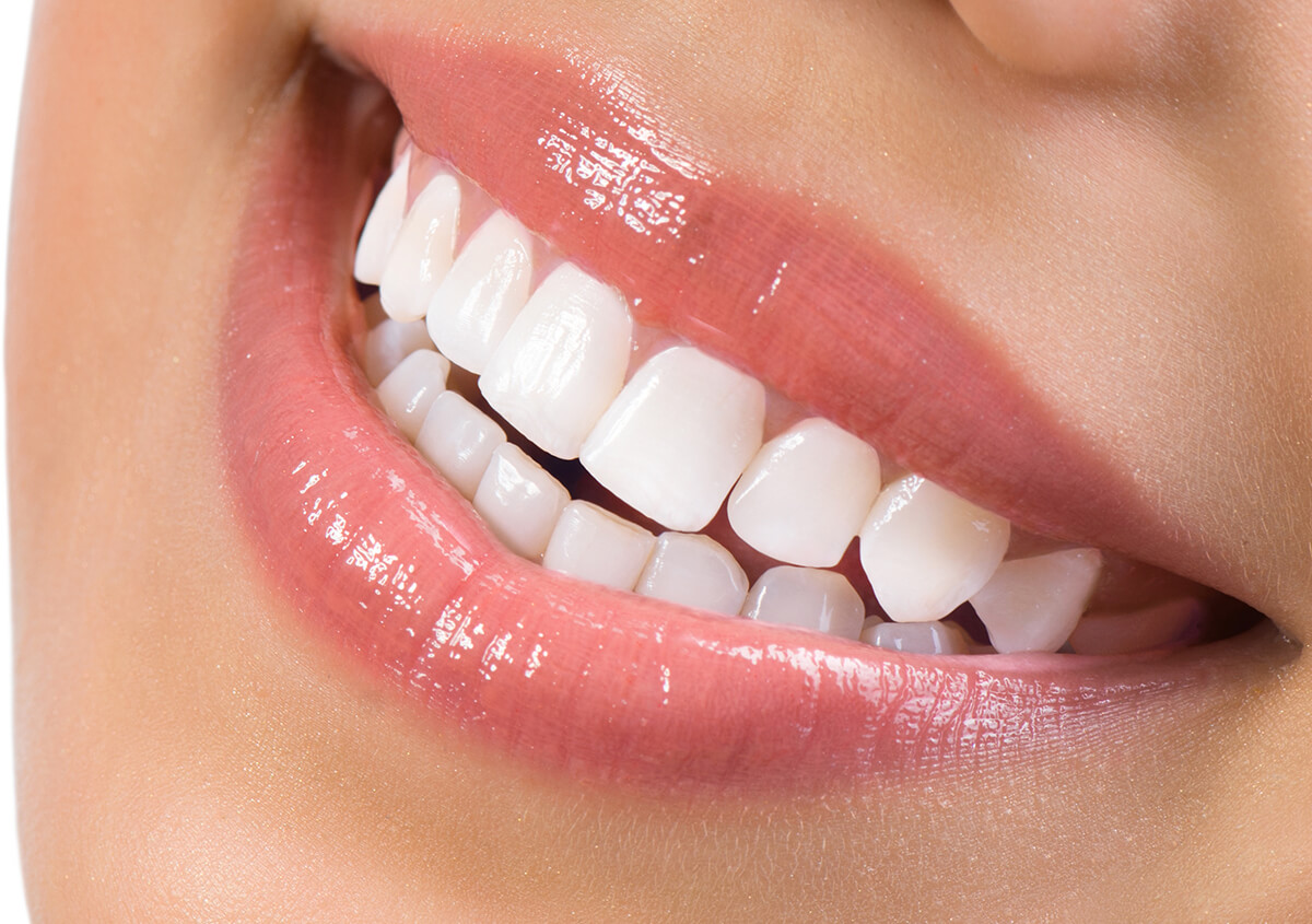 Zoom Teeth Whitening Treatment in Drumheller AB Area