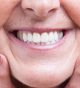 Restore your smile with high-quality, natural-looking dentures