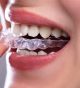Does Having Wisdom Teeth Affect Getting Invisalign?